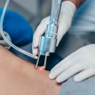Nahaufnahme eines Lasergeräts, welches von behandschuhten Händen auf ein Stück Haut platziert wird. Das Lasergerät gibt einen roten Punkt aus.